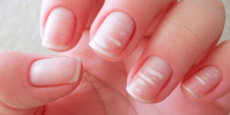 Кому нельзя пользоваться гель-лаком и почему?